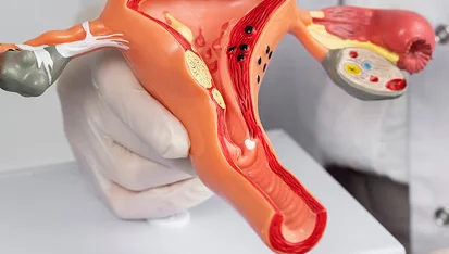 Vaginal Hysterectomy